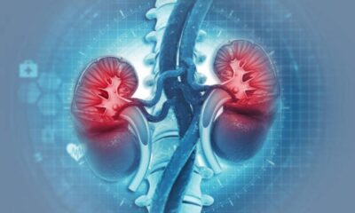 Top 20 Kidney Hospitals in India For Best Treatment